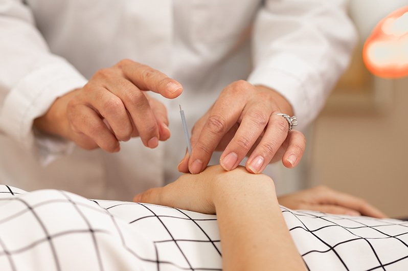 An image of needles being inserted during acupuncture treatment